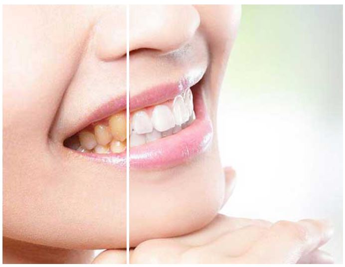 Chellammal Dental Care - Best ISO Certified Dental Clinic in Kallakurichi, Tamil Nadu