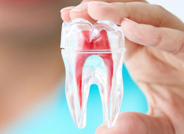 Root Canal Therapy in Kallakurichi - Chellammal Dental Care